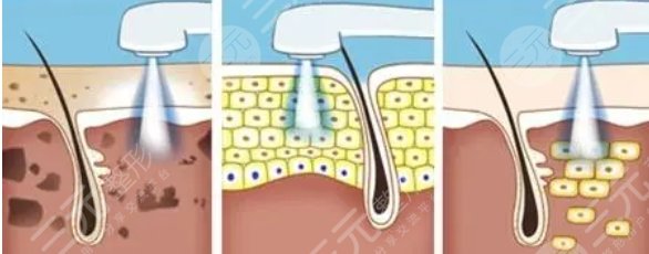 安徽醫(yī)科大學(xué)第一附屬醫(yī)院整形美容中心特色項目