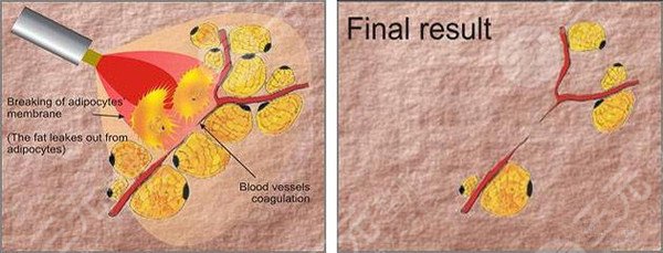 美容醫(yī)生黃曉哲怎么樣