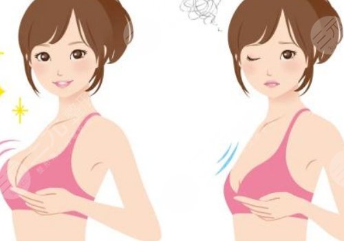 假體隆胸的牌子