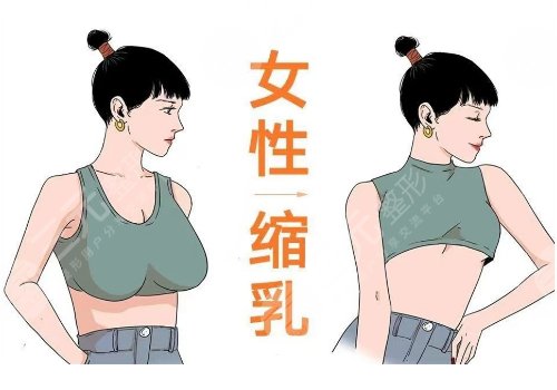 做縮胸手術(shù)需要多少錢