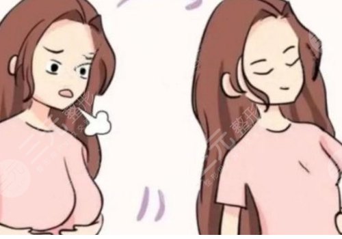 做縮胸手術(shù)需要多少錢