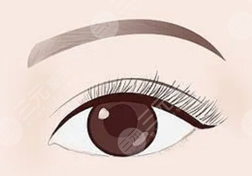 敖健飛修復(fù)雙眼皮嗎