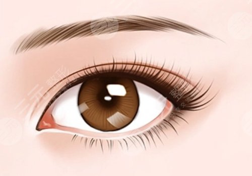 敖健飛修復(fù)雙眼皮嗎