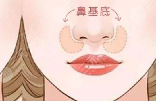 墊鼻基底