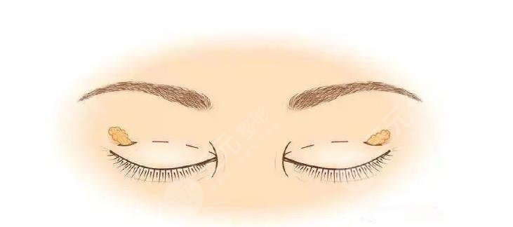 廈門臉博士做眼部綜合醫(yī)生