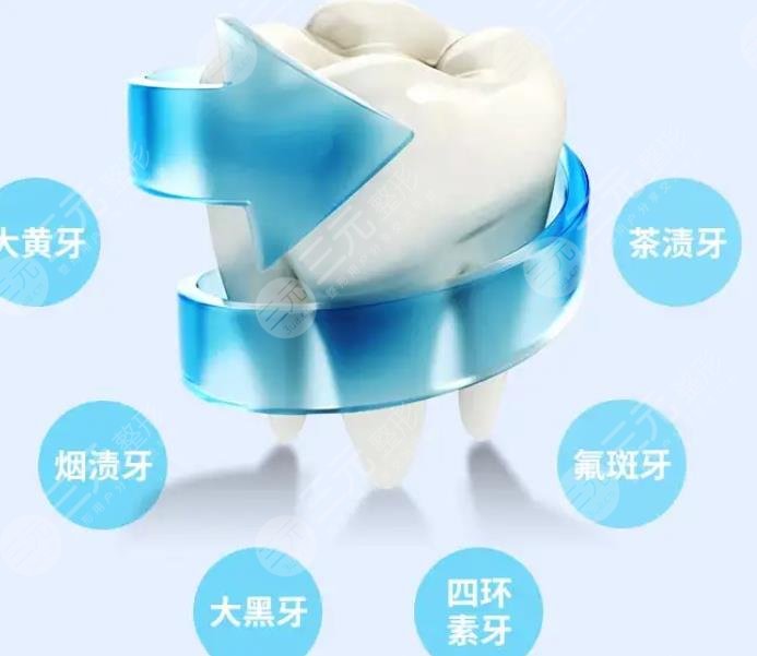 合肥濱湖醫(yī)院牙科洗牙案例