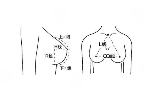 隆胸可以保持幾年