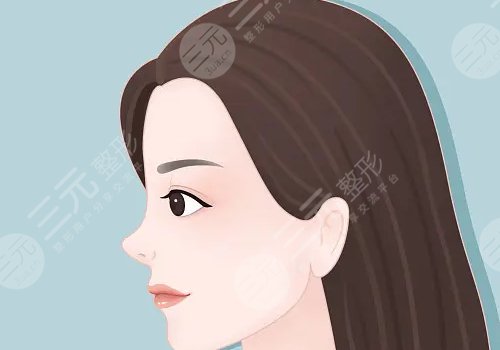 上海九院歪鼻矯正專家