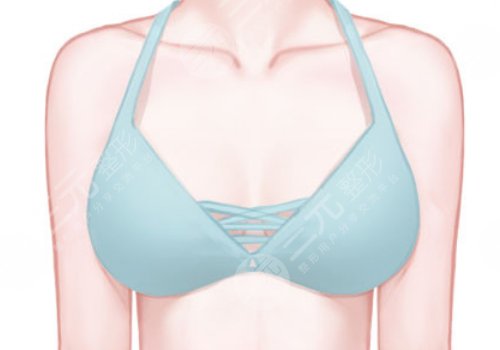 上海九醫(yī)院徐華和王濤乳房再造哪個好