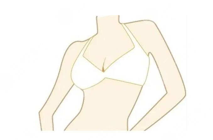 乳房懸吊手術(shù)保持幾年