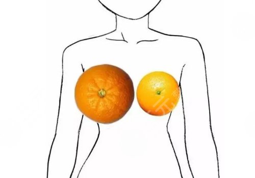 河南省人民醫(yī)院縮胸手術(shù)的好醫(yī)生