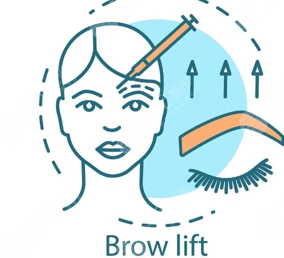 金奇龍醫(yī)生提眉手術(shù)案例