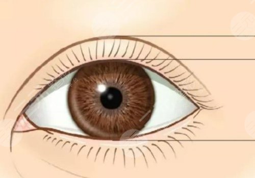 衡陽雅美醫(yī)療美容醫(yī)院雙眼皮怎么樣