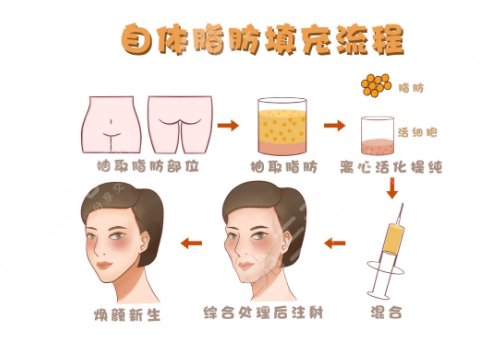 海南省?？诩t妝尚醫(yī)院怎么樣