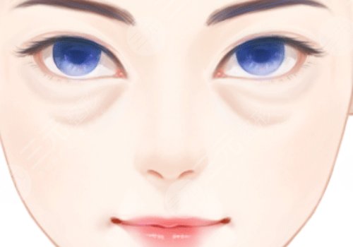 汕頭萊美醫(yī)療美容門診部去眼袋價(jià)格