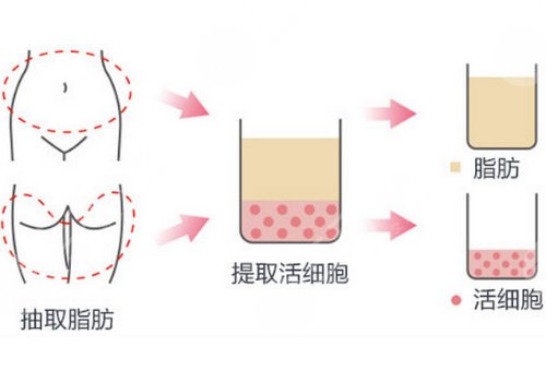 馬菁晶雙眼皮修復(fù)怎么樣