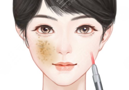 汕頭萊美醫(yī)療美容門診部祛斑價格