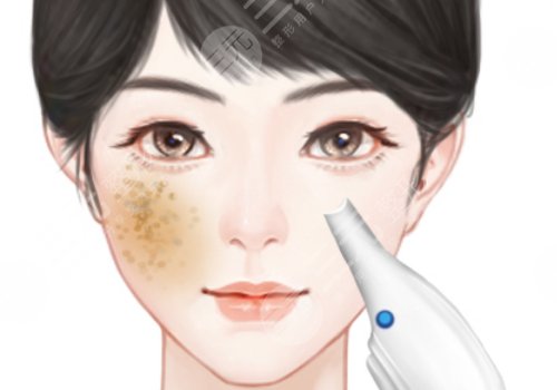 汕頭萊美醫(yī)療美容門診部祛斑價格