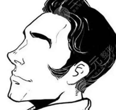 鬢角毛發(fā)種植