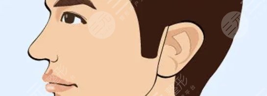 鬢角毛發(fā)種植