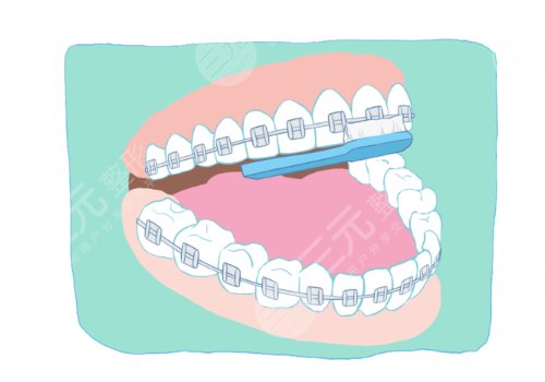 汕頭奧詩(shī)卡口腔醫(yī)院怎么樣
