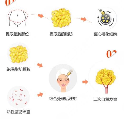 貴陽利美康醫(yī)院脂肪填充面部案例