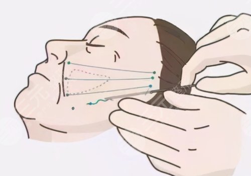 廣東涵美醫(yī)療美容醫(yī)院怎么樣