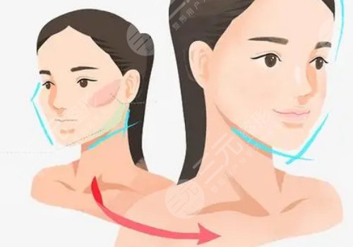 下頜骨歪了怎么矯正