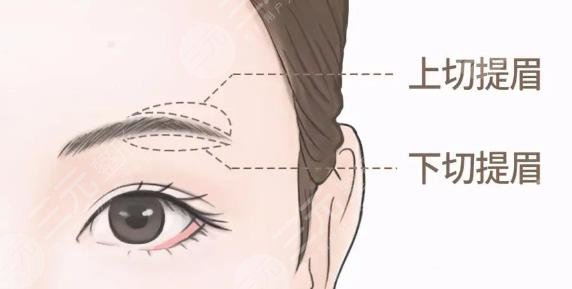 提眉