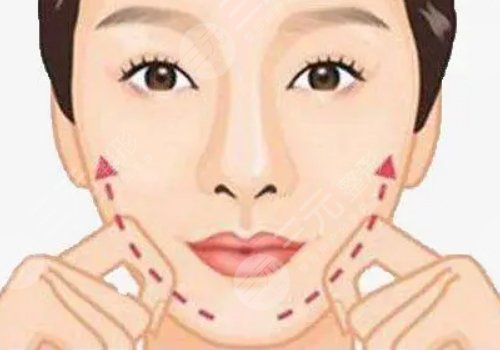 汕頭曙光醫(yī)療美容門診部瘦臉怎么樣