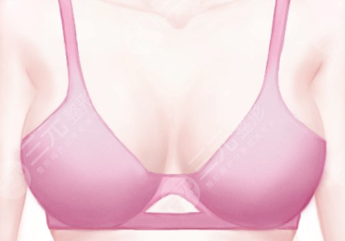 汕頭附二整形美容科價格