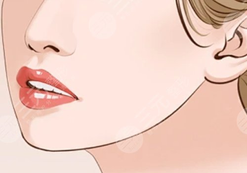 磨下頜骨手術(shù)一般多少錢