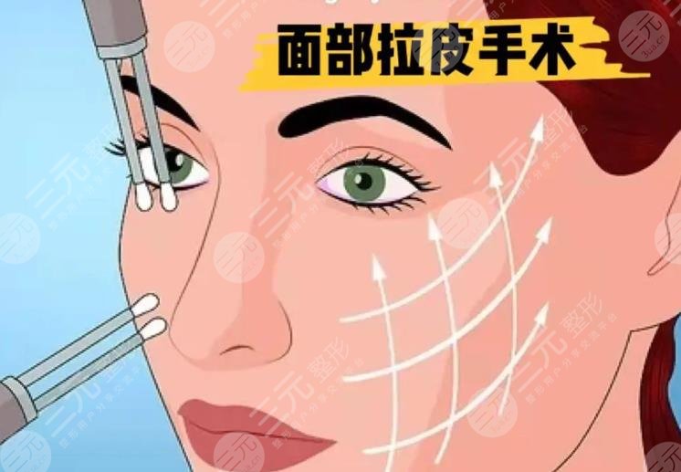 拉皮手術(shù)