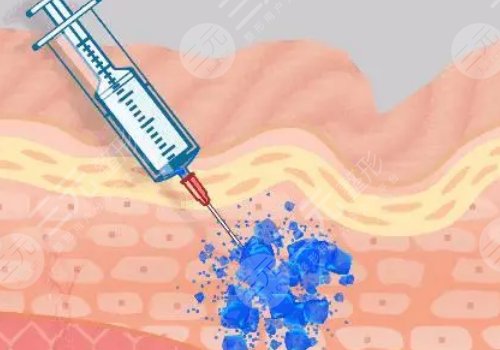 佛山市第一人民醫(yī)院醫(yī)學(xué)美容科怎么樣