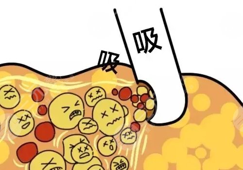 佛山市第二人民醫(yī)院醫(yī)學(xué)美容科鼻整形專家