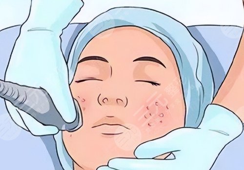 佛山市第二人民醫(yī)院醫(yī)學美容科祛斑多少錢