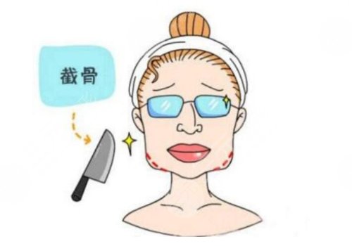 下頜角磨骨手術(shù)需要多少錢