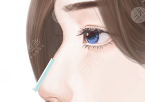 徐路生隆鼻可靠嗎