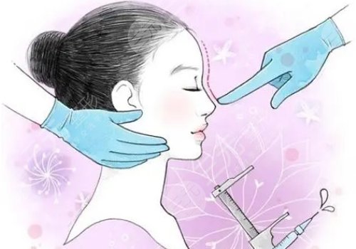 整鼻子要多少錢