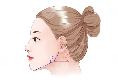 下頜角磨骨手術(shù)風(fēng)險(xiǎn)大嗎