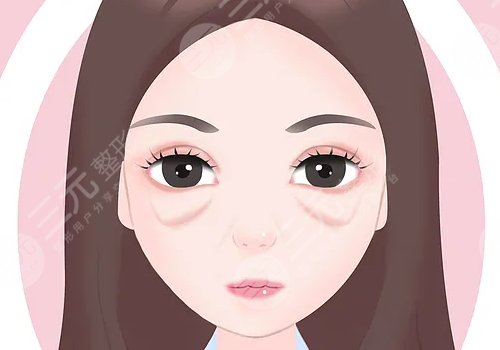 省中醫(yī)馬志兵雙眼皮怎樣