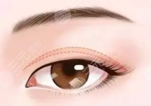 孔偉立是湘雅的醫(yī)生嗎