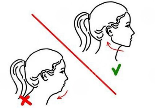 下頜骨后縮怎么矯正