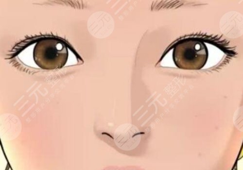 姜留剛雙眼皮案例怎么樣的