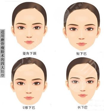 下頜骨一高一低臉歪怎么矯正