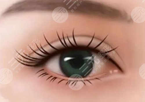 郭彩春醫(yī)生雙眼皮怎么樣