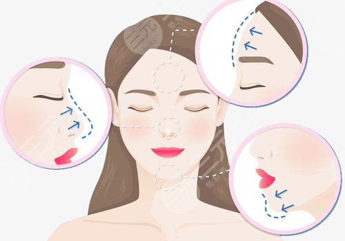 什么是輪廓固定抗衰