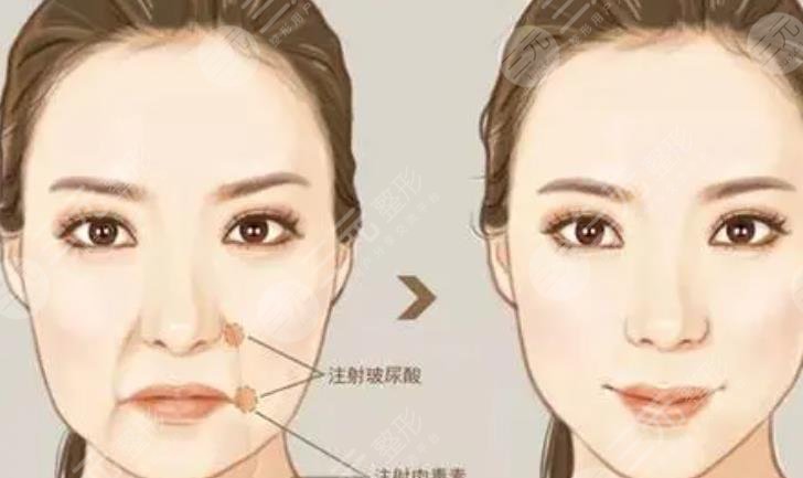 潤(rùn)致熨紋針