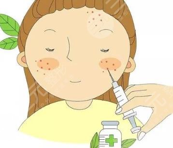 潤(rùn)致熨紋針