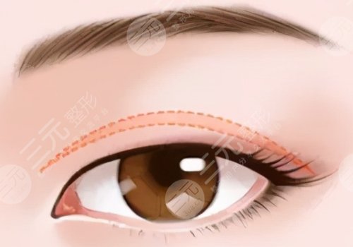 青島大學附屬醫(yī)院整形科怎么樣